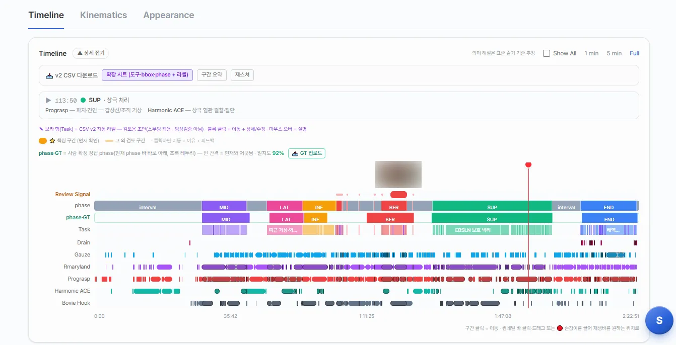 케이스 리포트의 Timeline